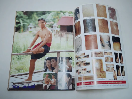 นายขนมต้ม รูปที่ 9