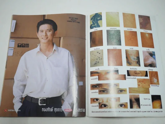 เข็มซ่อนปลาย รูปที่ 12