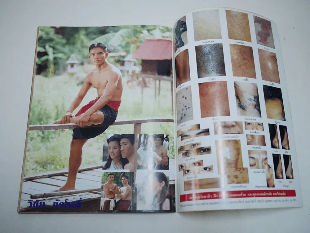 นายขนมต้ม รูปที่ 9