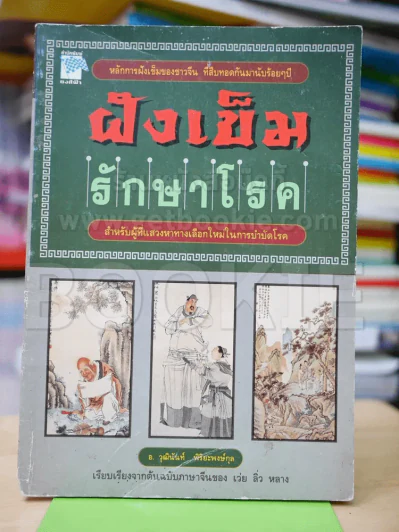 ฝังเข็มรักษาโรค รูปที่ 1