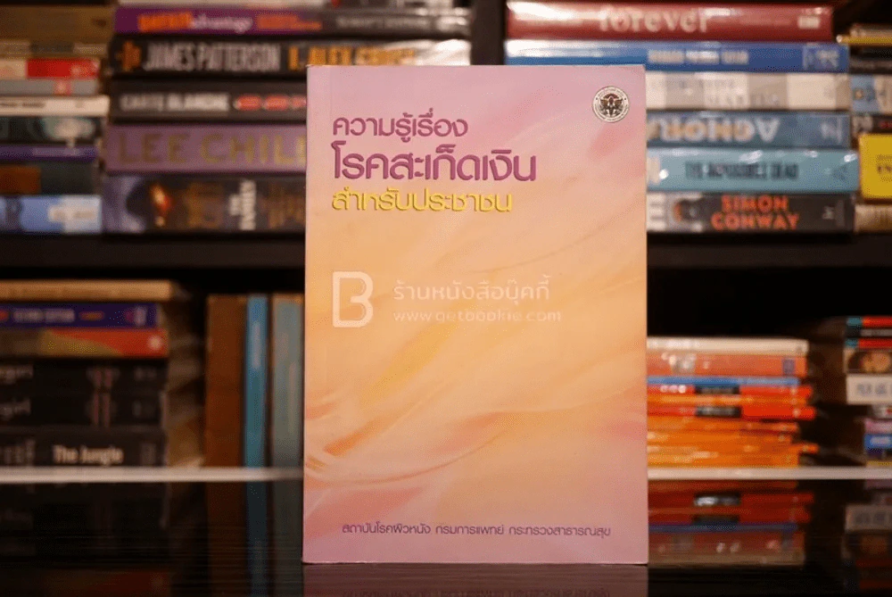 ความรู้เรื่องโรคสะเก็ดเงิน สำหรับประชาชน รูปที่ 1