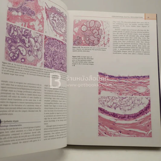 Diagnostic Problems in Breast Pathology รูปที่ 3