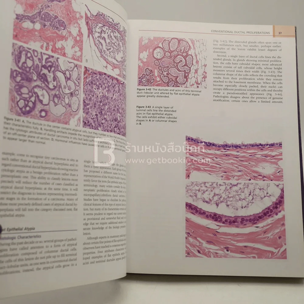 Diagnostic Problems in Breast Pathology รูปที่ 3