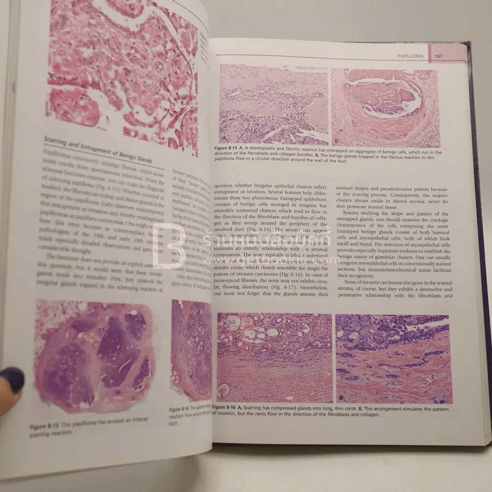 Diagnostic Problems in Breast Pathology รูปที่ 4