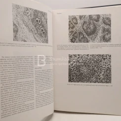 Tumors of the Fetus and Infant - An Atlas รูปที่ 4