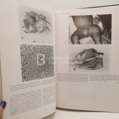 Tumors of the Fetus and Infant - An Atlas รูปที่ 5