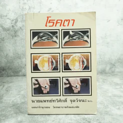 โรคตา - นายแพทย์ทวีศักดิ์ จุลวัจนะ รูปที่ 1