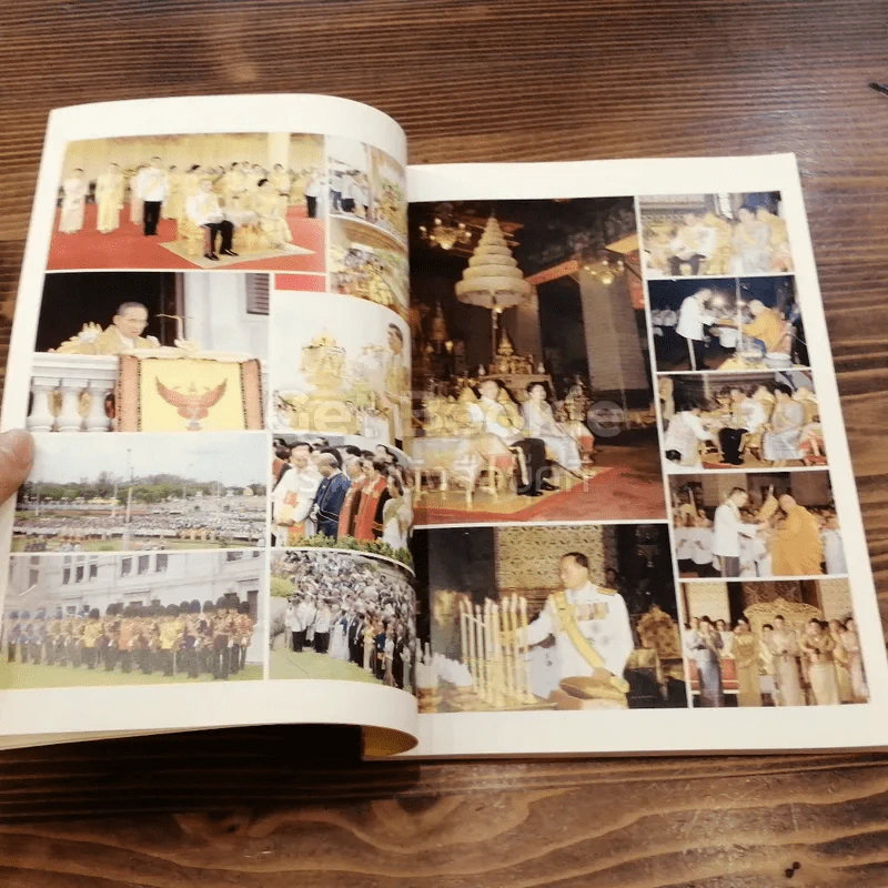 วารสารมูลนิธิโรคไตแห่งประเทศไทย ปีที่ 20 ฉบับที่ 40 กรกฎาคม 2549 รูปที่ 4