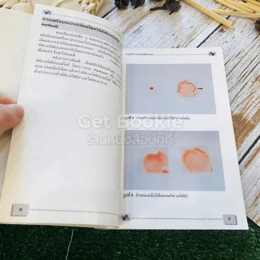โลหิตวิทยา Hematology รูปที่ 13