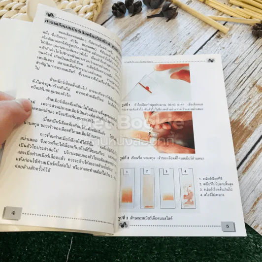 โลหิตวิทยา Hematology รูปที่ 12