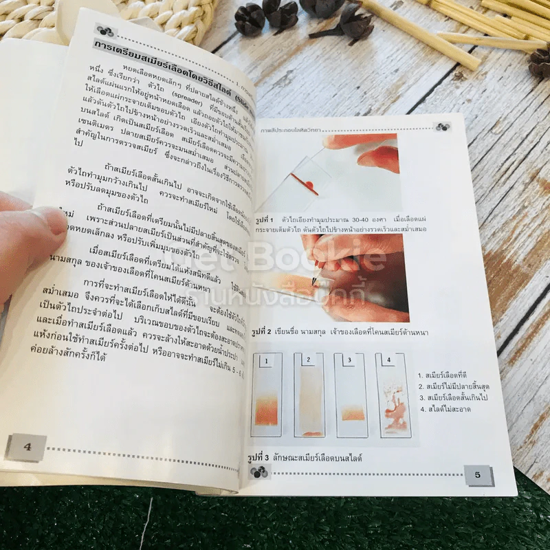 โลหิตวิทยา Hematology รูปที่ 12