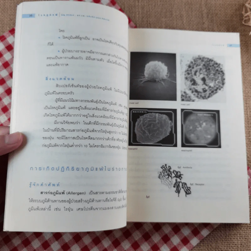 โรคภูมิแพ้ Allergy - แพทย์หญิงสิรินันท์ บุญยะลีพรรณ รูปที่ 21