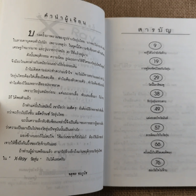 X Ray วัยรุ่น - จตุพล ชมภูนิช รูปที่ 9