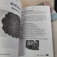 กินเป็น ลืมป่วย ล้างสารพิษในร่างกาย - อ.สุทธิวัสส์ คำภา รูปที่ 12