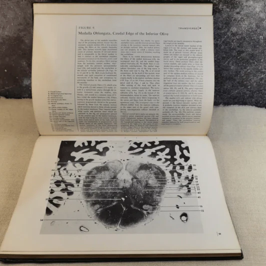 Atlas of the Central Nervous System in Man - Miller & Burack รูปที่ 11