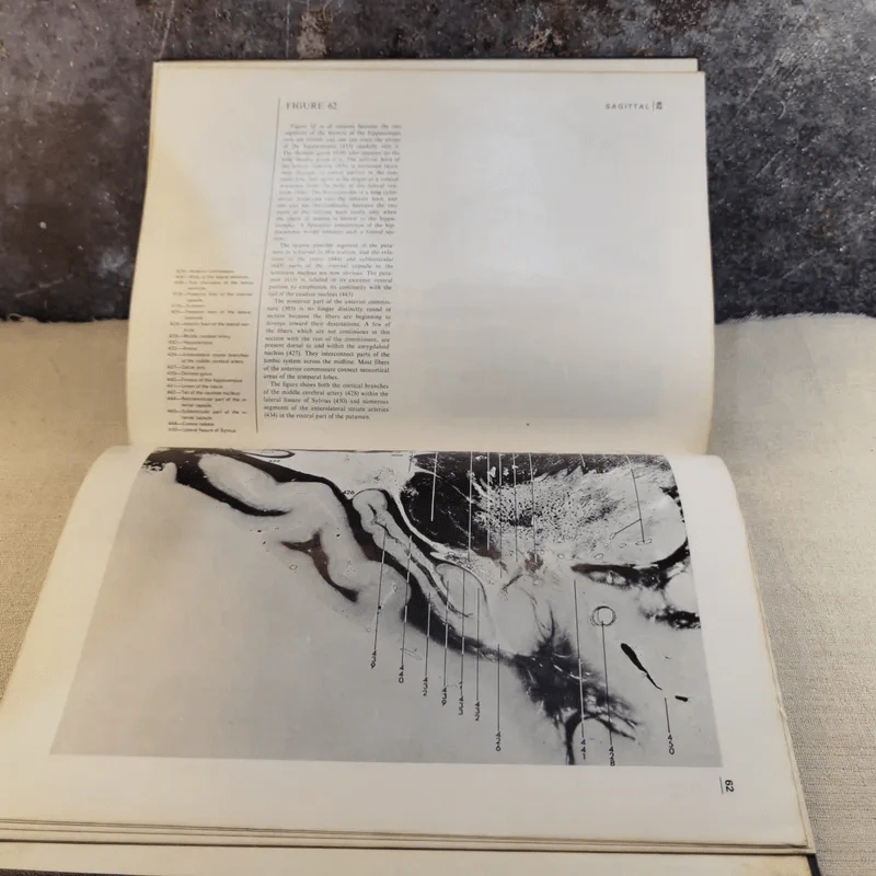 Atlas of the Central Nervous System in Man - Miller & Burack รูปที่ 13