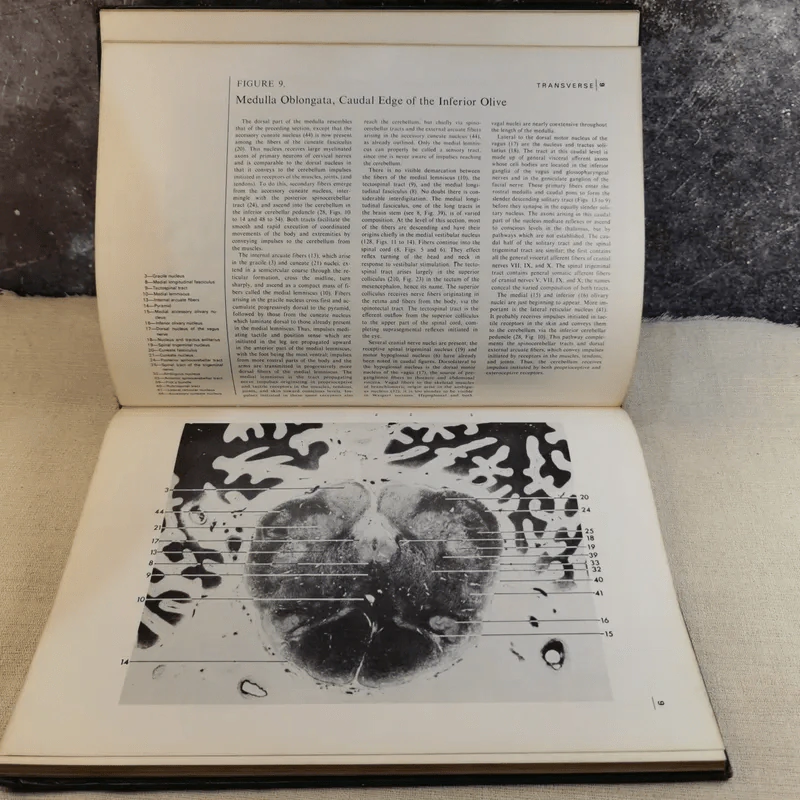 Atlas of the Central Nervous System in Man - Miller & Burack รูปที่ 11