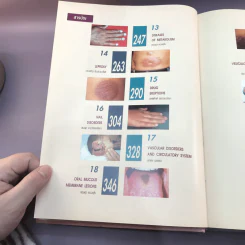 Dermatology 2000 ตำราโรคผิวหนังในเวชปฏิบัติปัจจุบัน รูปที่ 20