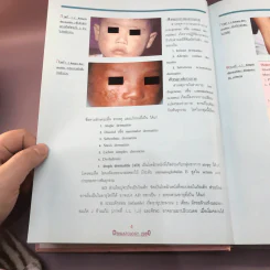 Dermatology 2000 ตำราโรคผิวหนังในเวชปฏิบัติปัจจุบัน รูปที่ 26