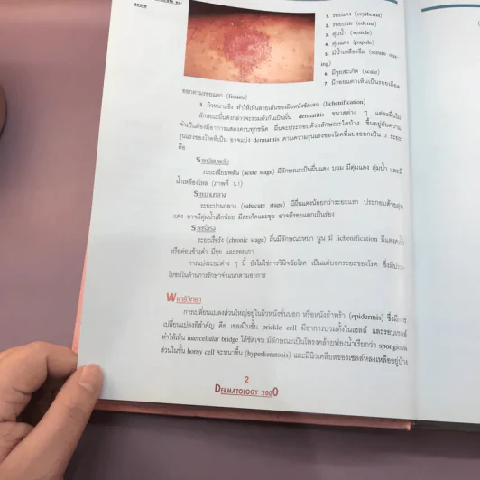 Dermatology 2000 ตำราโรคผิวหนังในเวชปฏิบัติปัจจุบัน รูปที่ 24