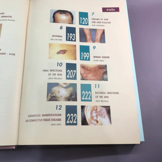 Dermatology 2000 ตำราโรคผิวหนังในเวชปฏิบัติปัจจุบัน รูปที่ 19