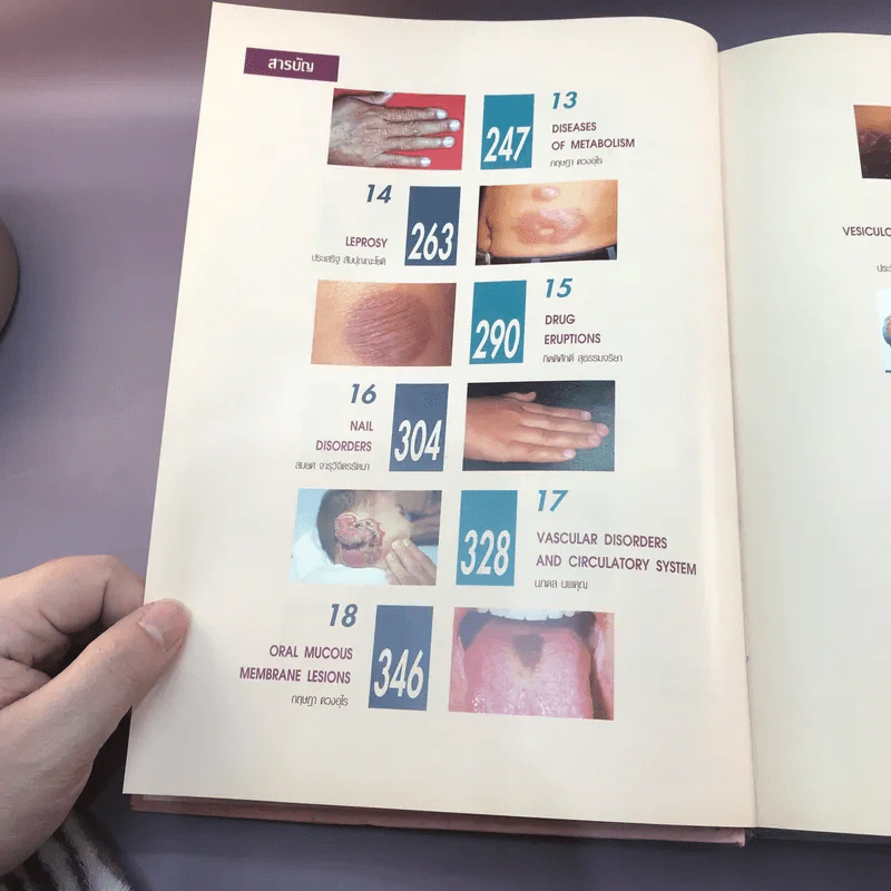 Dermatology 2000 ตำราโรคผิวหนังในเวชปฏิบัติปัจจุบัน รูปที่ 20