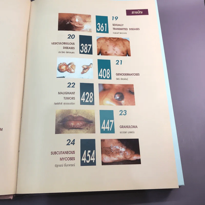 Dermatology 2000 ตำราโรคผิวหนังในเวชปฏิบัติปัจจุบัน รูปที่ 21