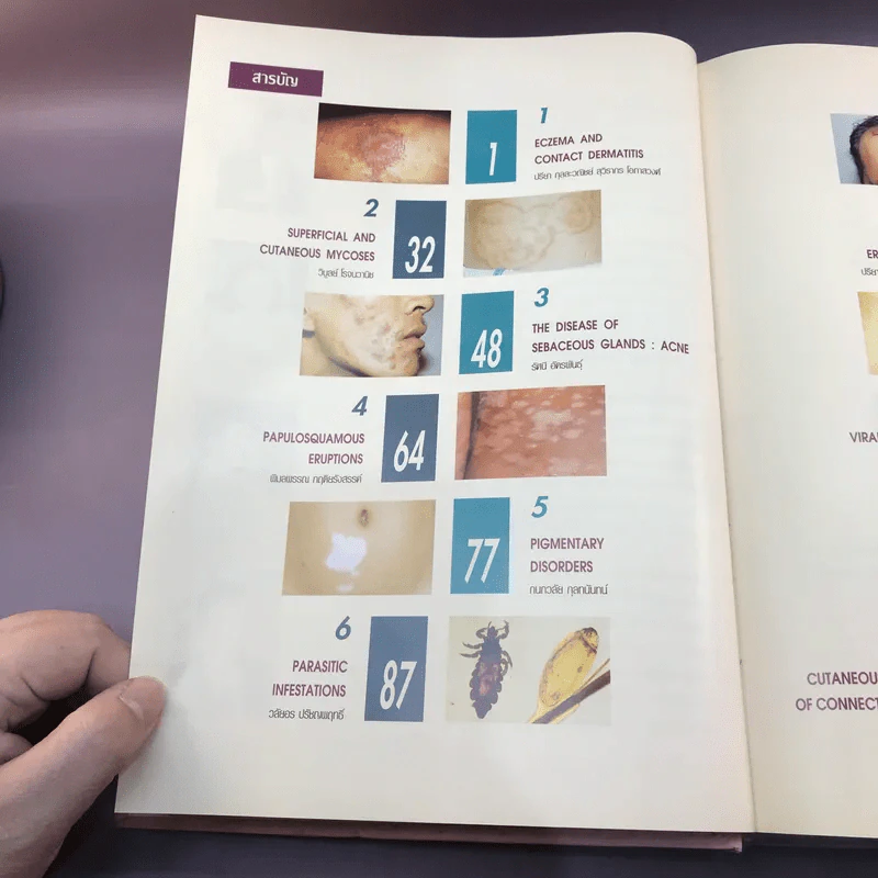 Dermatology 2000 ตำราโรคผิวหนังในเวชปฏิบัติปัจจุบัน รูปที่ 18
