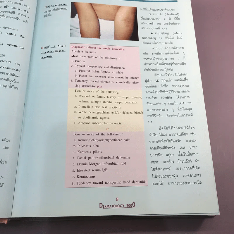 Dermatology 2000 ตำราโรคผิวหนังในเวชปฏิบัติปัจจุบัน รูปที่ 27