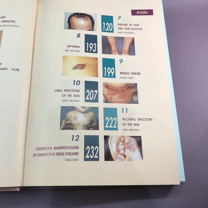 Dermatology 2000 ตำราโรคผิวหนังในเวชปฏิบัติปัจจุบัน รูปที่ 19