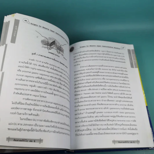 ศัลยศาสตร์ทั่วไป General Surgery Vol.6 รูปที่ 14