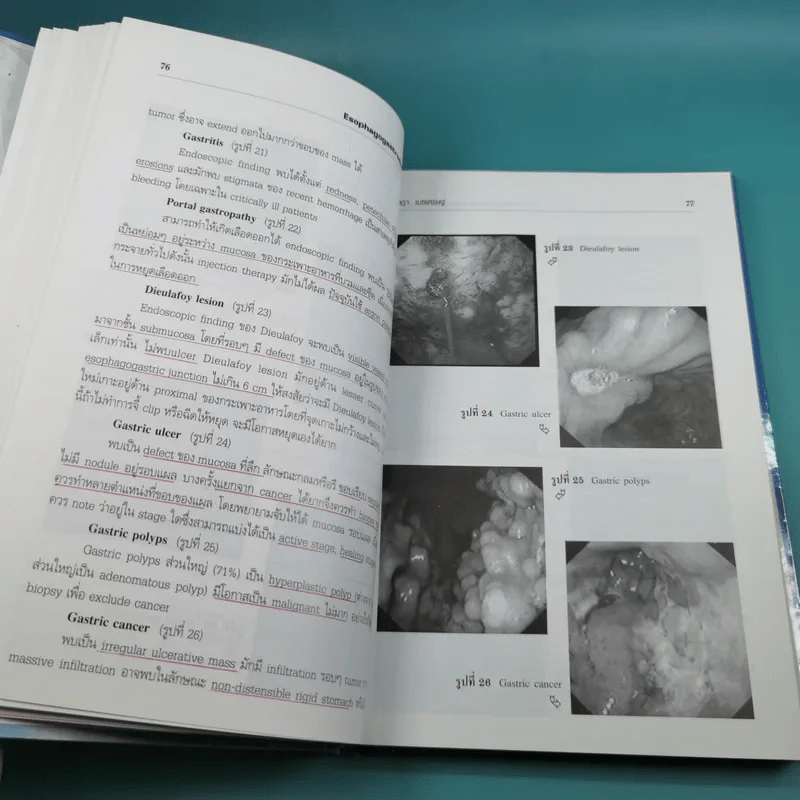 ศัลยศาสตร์วิวัฒน์ Gastrointestinal Endoscopy รูปที่ 14