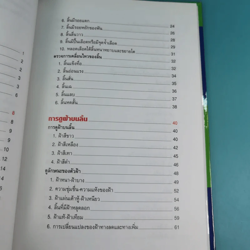 ทฤษฎีแพทย์จีน ลิ้นบอกโรค - นายแพทย์ภาสกิจ (วิทวัส) วัณนาวิบูล รูปที่ 10