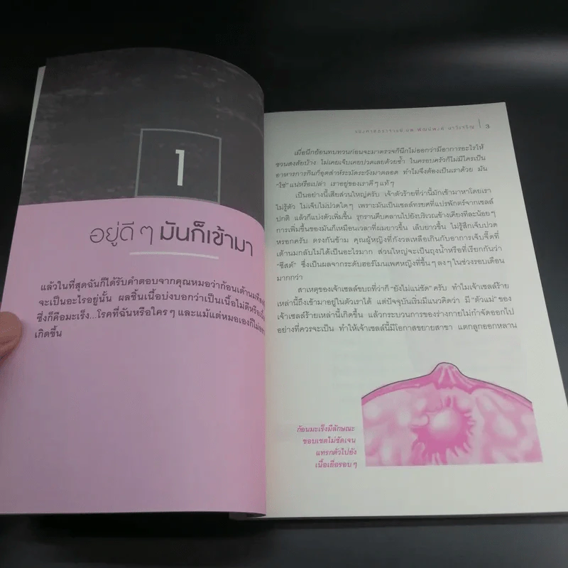 มะเร็งเต้านม เจาะลึกวิธีวินิจฉัยและแผนการรักษาทุกขั้นตอน รูปที่ 14