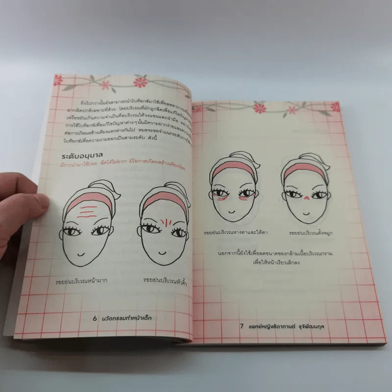 นวัตกรรมทำหน้าเด็ก - แพทย์หญิงธิดากานต์ รุจิพัฒนกุล รูปที่ 15