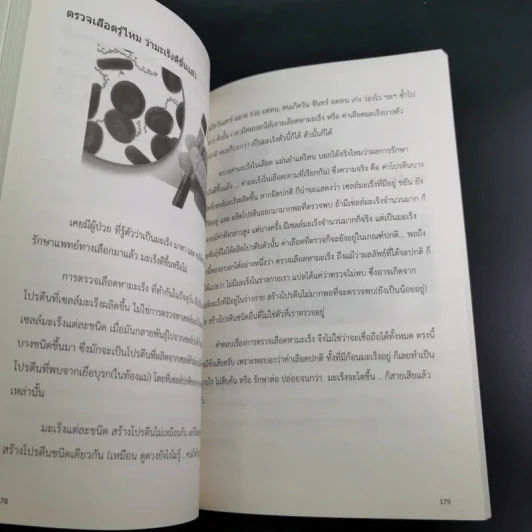 รู้จักมะเร็ง อยู่กับมะเร็ง - อดุลย์ รัตนวิจิตราศิลป์ รูปที่ 14
