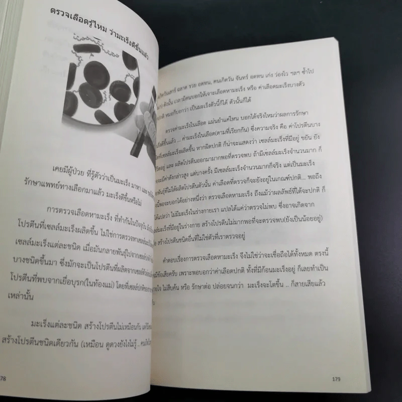 รู้จักมะเร็ง อยู่กับมะเร็ง - อดุลย์ รัตนวิจิตราศิลป์ รูปที่ 14
