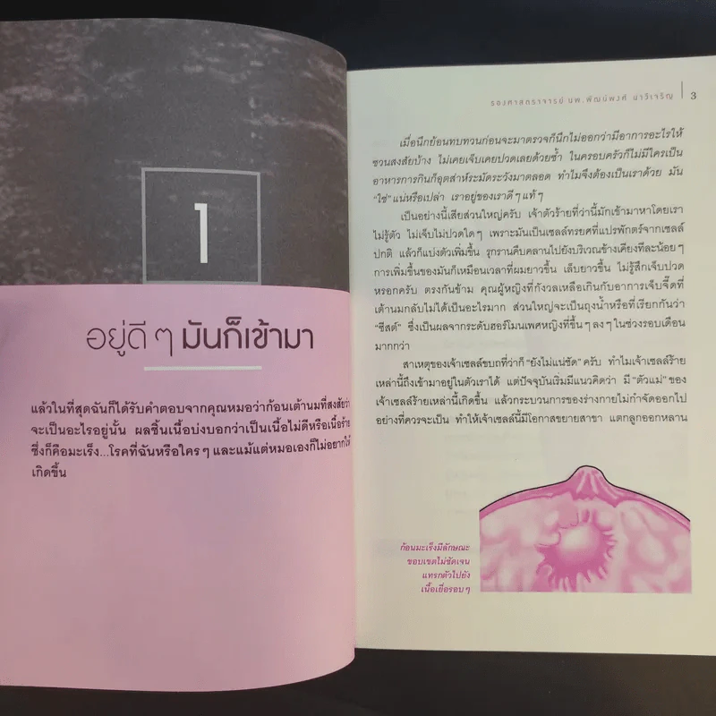 มะเร็งเต้านม เจาะลึกวิธีวินิจฉัยและแผนการรักษาทุกขั้นตอน รูปที่ 12