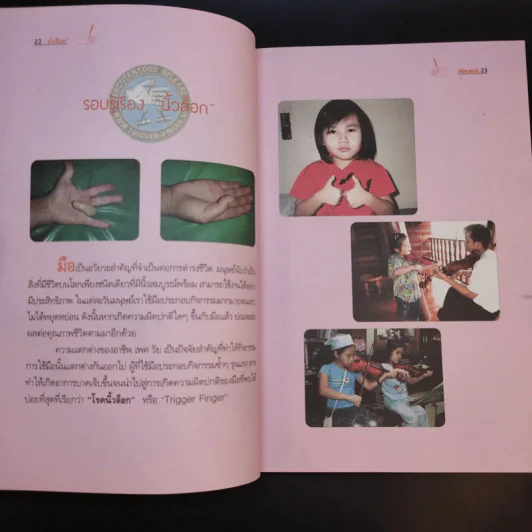 นิ้วล็อก Trigger Finger - นายแพทย์วิชัย วิจิตรพรกุล รูปที่ 15