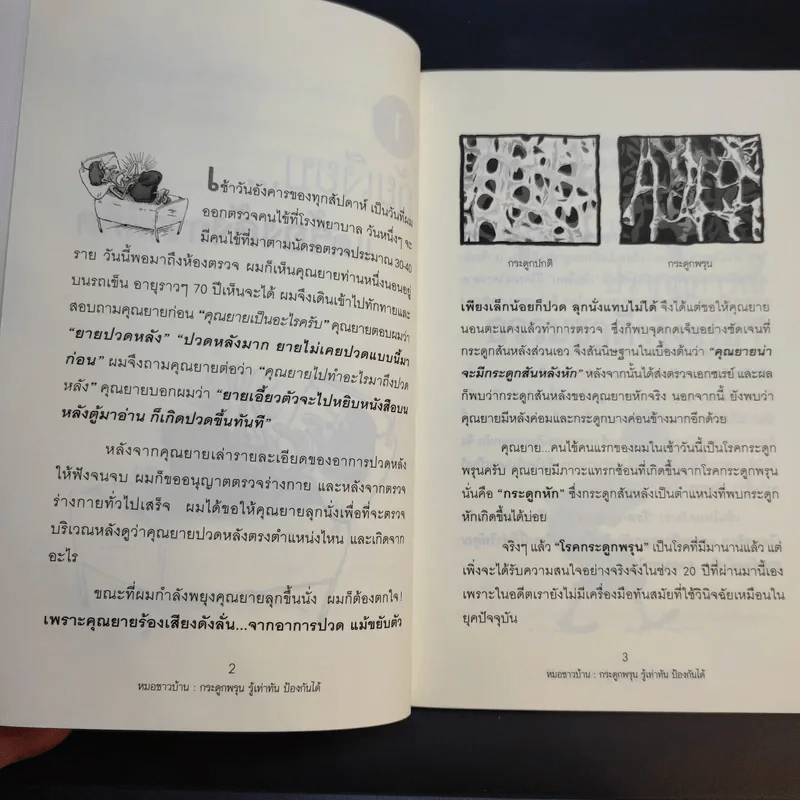 กระดูกพรุน รู้เท่าทัน ป้องกันได้ - นพ.ฉัตรเลิศ พงษ์ไชยกุล รูปที่ 13