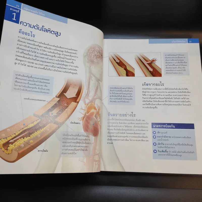 ชีวิตปลอดโรค - Reader's Digest รีดเดอร์สไดเจสท์ รูปที่ 14