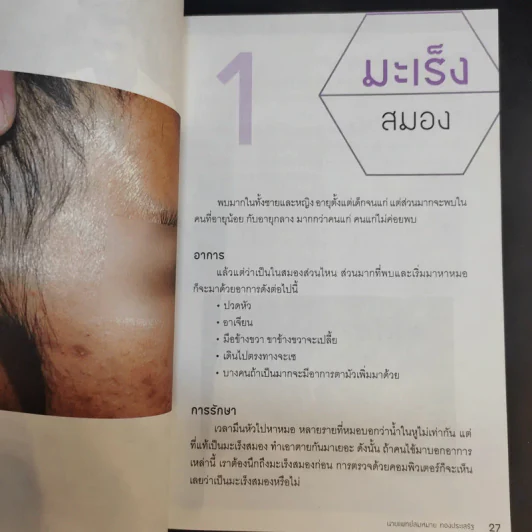 รู้ทันมะเร็ง 2 ฉบับสมบูรณ์ - นายแพทย์สมหมาย ทองประเสริฐ รูปที่ 13