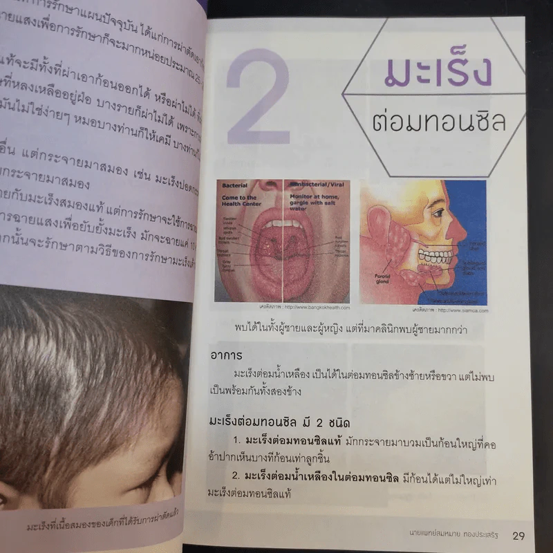 รู้ทันมะเร็ง 2 ฉบับสมบูรณ์ - นายแพทย์สมหมาย ทองประเสริฐ รูปที่ 14
