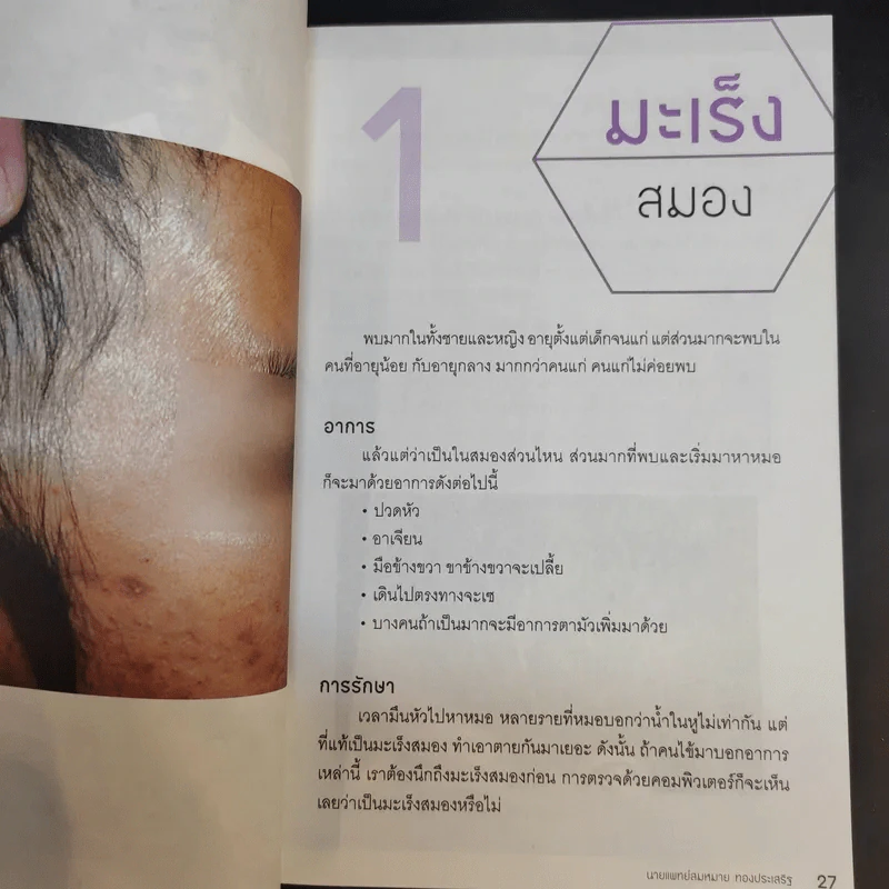 รู้ทันมะเร็ง 2 ฉบับสมบูรณ์ - นายแพทย์สมหมาย ทองประเสริฐ รูปที่ 13