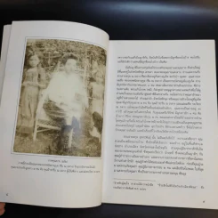 มะเร็งขึ้นสมอง - ชูเกียรติ อุทกะพันธุ์ รูปที่ 14