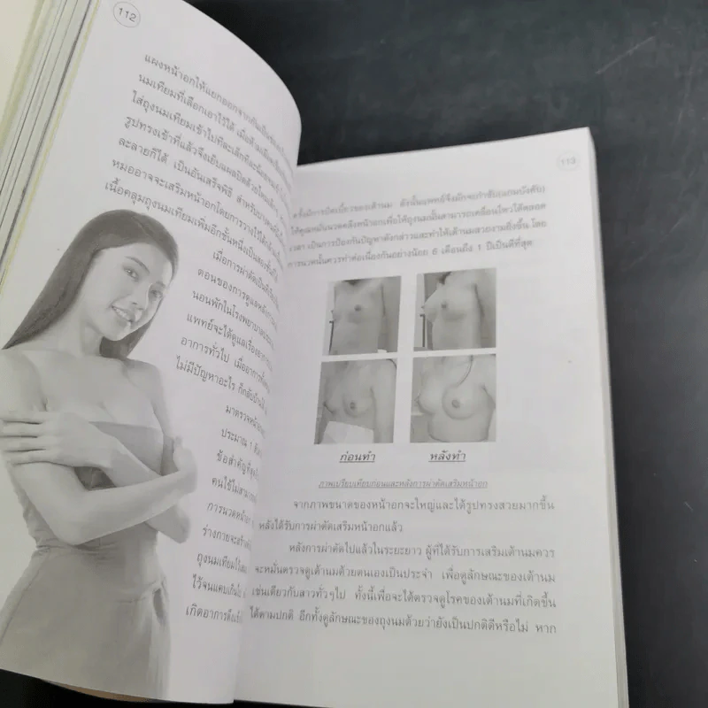 สวยด้วยแพทย์ - คณะแพทย์ ร.พ.ยันฮี รูปที่ 14