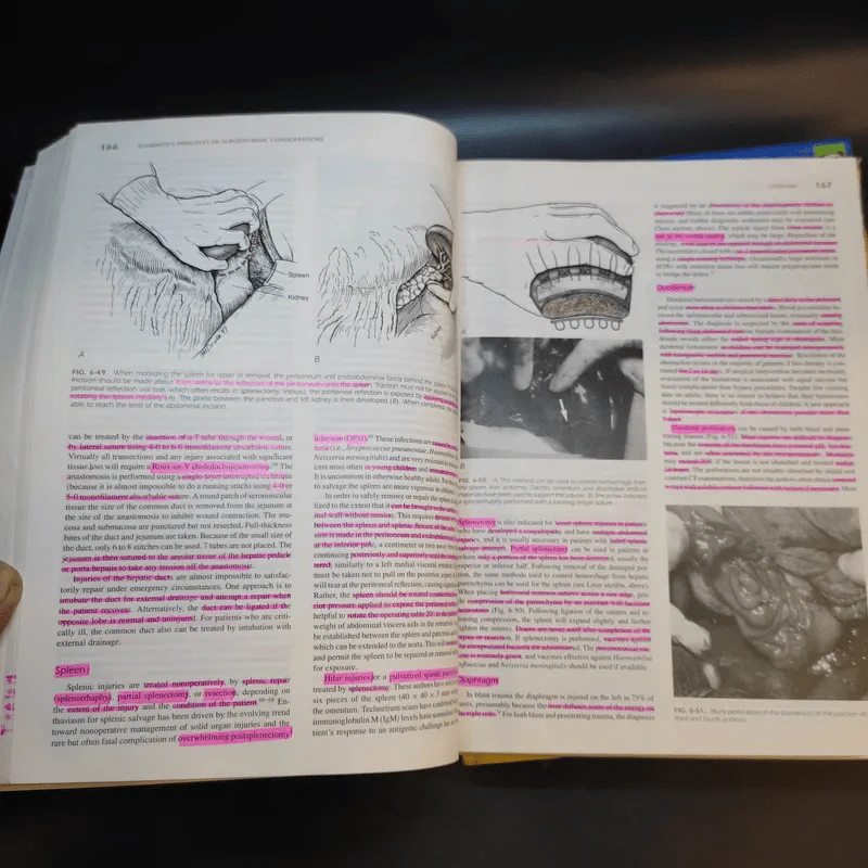 Schwartz's Principles of Surgery Special+Basic รูปที่ 18
