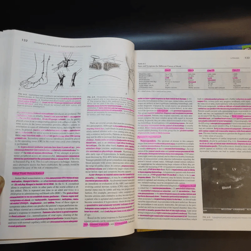 Schwartz's Principles of Surgery Special+Basic รูปที่ 19