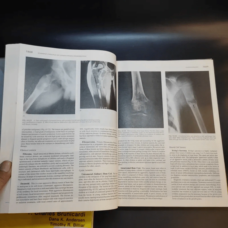 Schwartz's Principles of Surgery Special+Basic รูปที่ 25