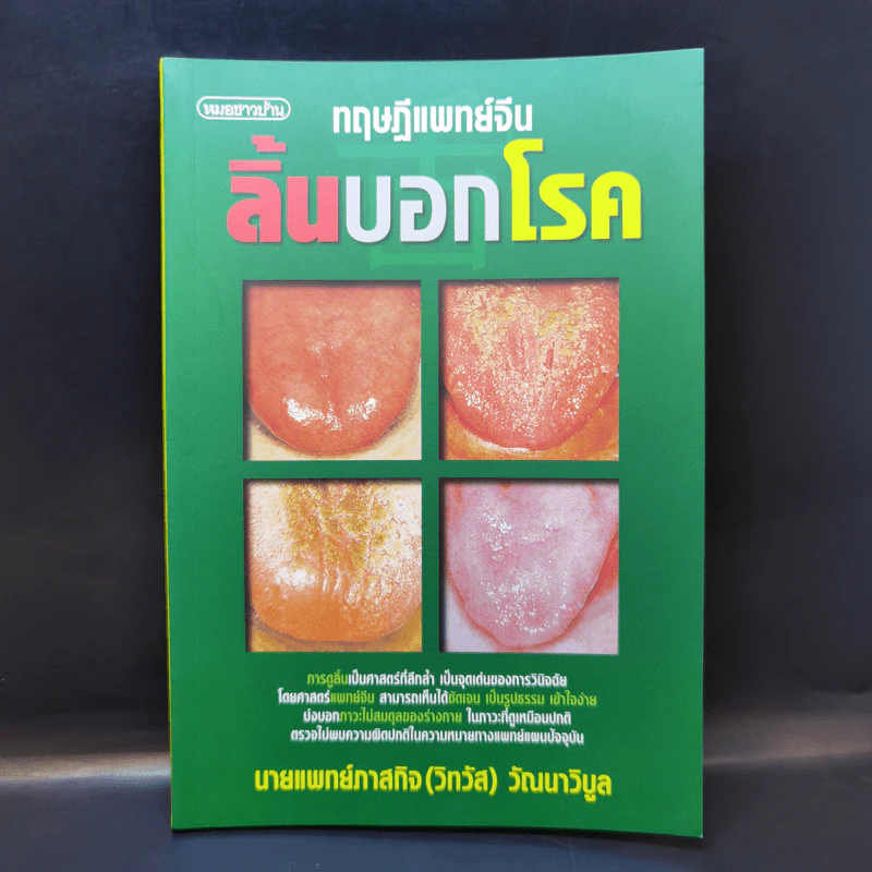 ทฤษฎีแพทย์จีน ลิ้นบอกโรค - นายแพทย์ภาสกิจ (วิทวัส) วัณนาวิบูล รูปที่ 1